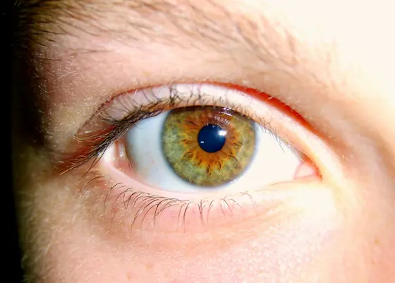 eyes